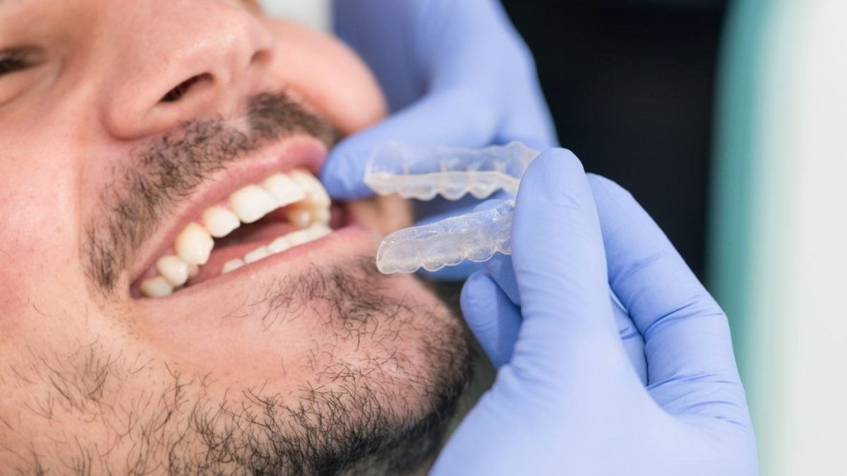 The Complete Guide to Invisalign: Cost, and Other Frequently Asked Questions